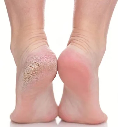 Смарт педикюр